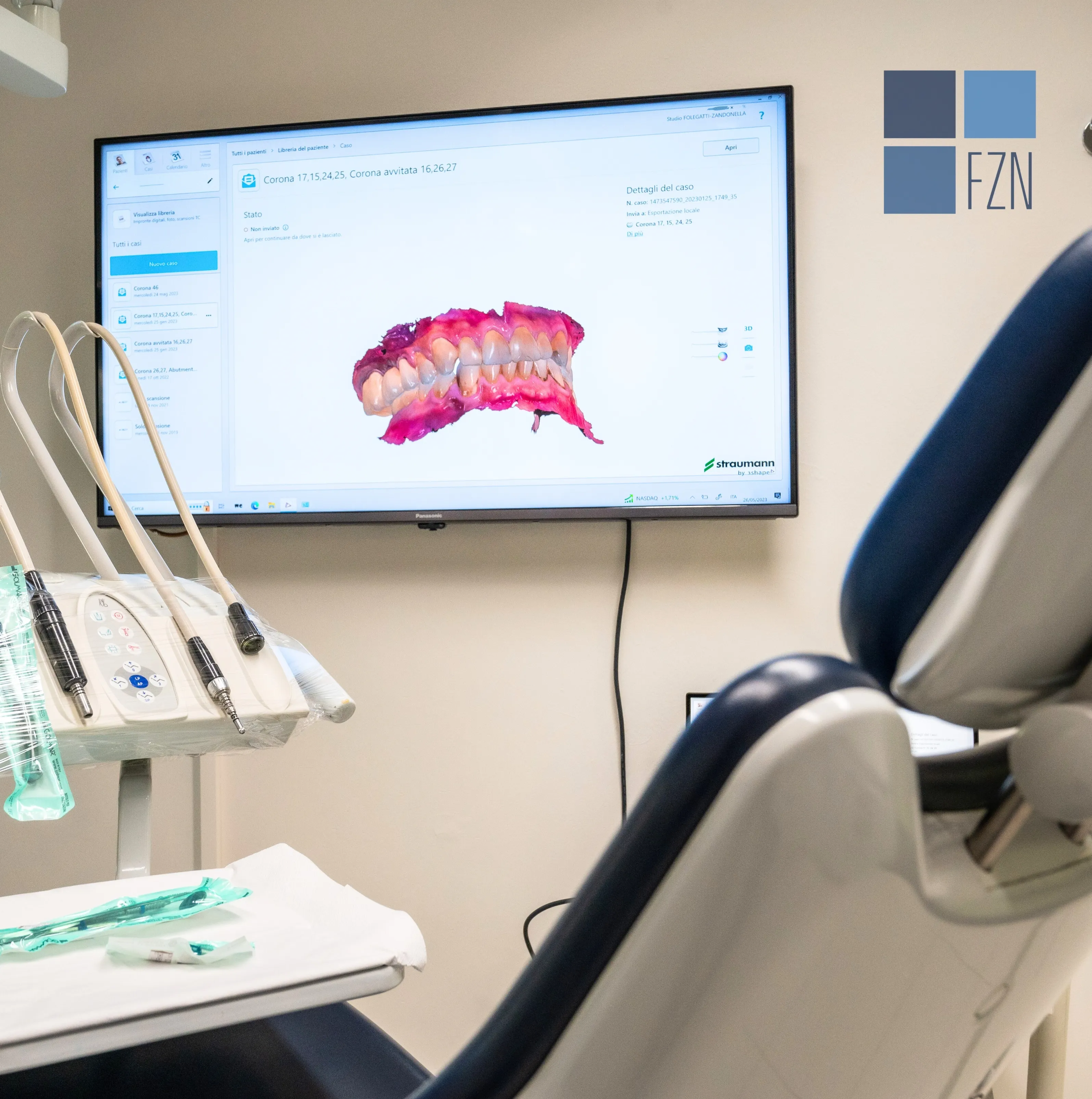 Estetica dentale: come migliorare il sorriso