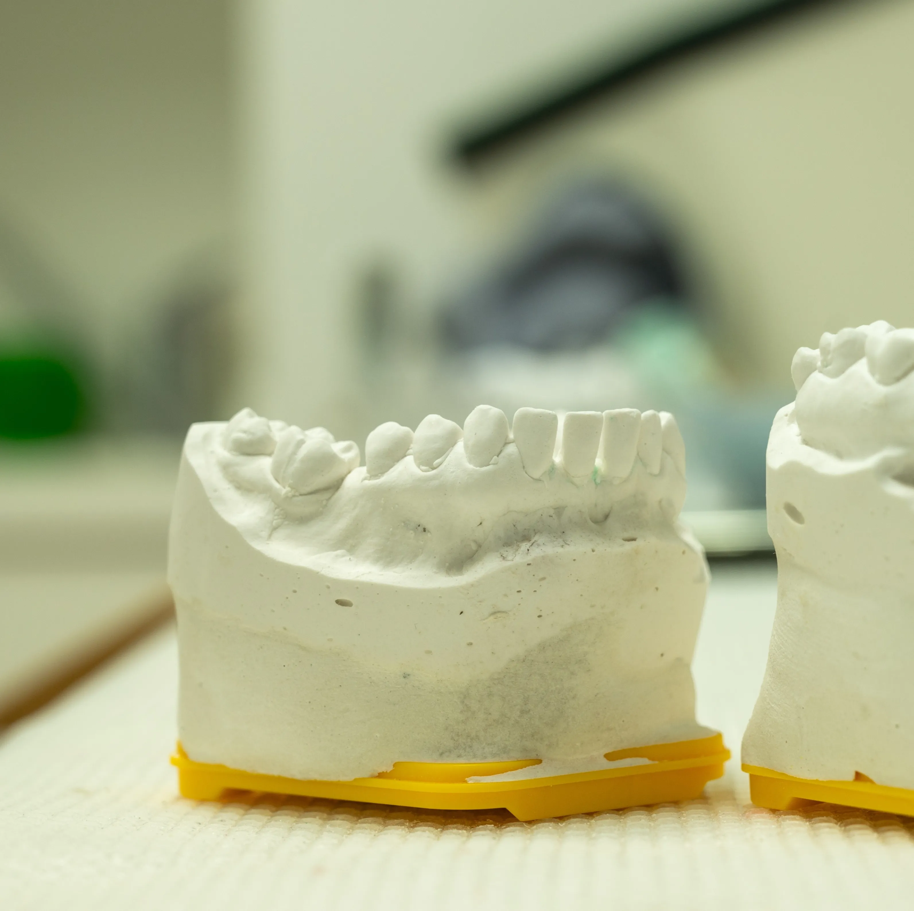 Implantologia dentale: cosa sapere prima di un intervento